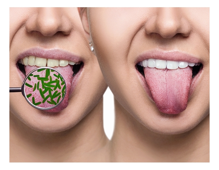 舌が白いと口臭が発生 舌苔の除去方法をチェック ウーマンウェルネス研究会 Supported By Kao